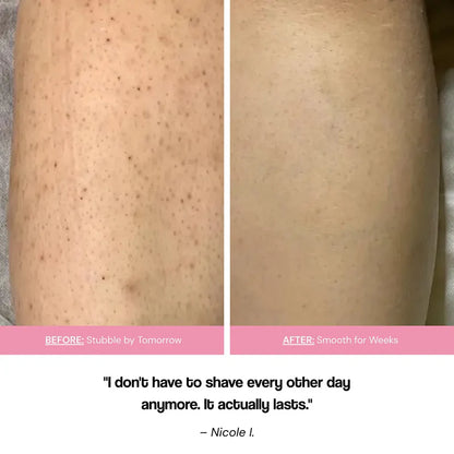 Bare Basics No Shave Hair Removal Cream
